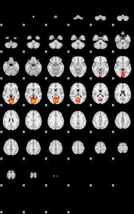 Patients 29115 122