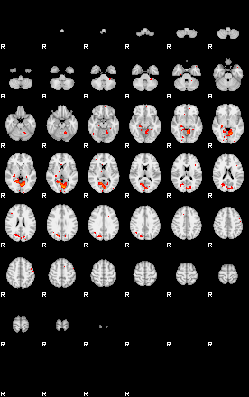 Patients 29150 140