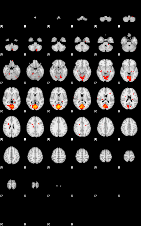 Patients 29189 142