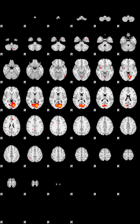 Patients 29677 125