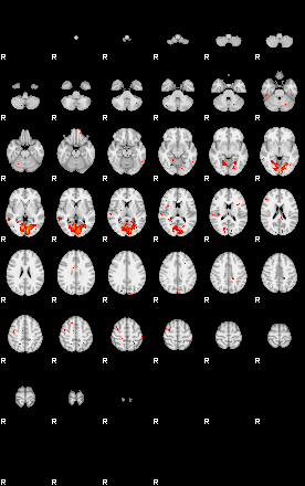 Patients 30000 136