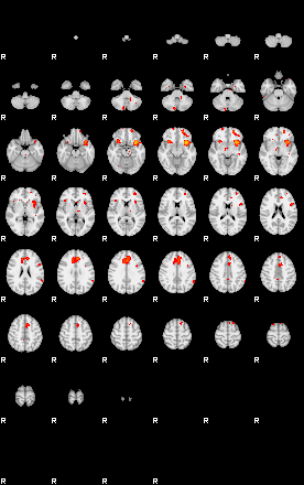 Patients 29150 1