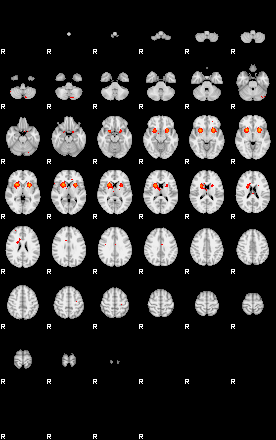 Patients 28692 193