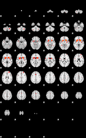 Patients 29015 106