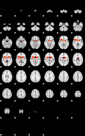 Patients 29161 63