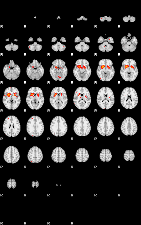 Patients 29179 101