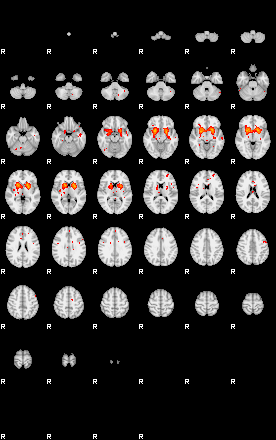 Patients 29201 100