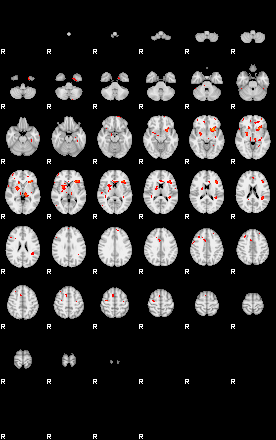 Patients 29391 43