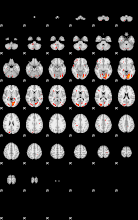 Patients 29105 3