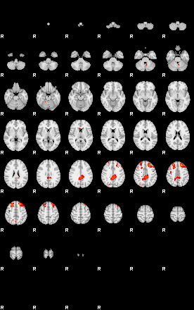 Patients 29164 6