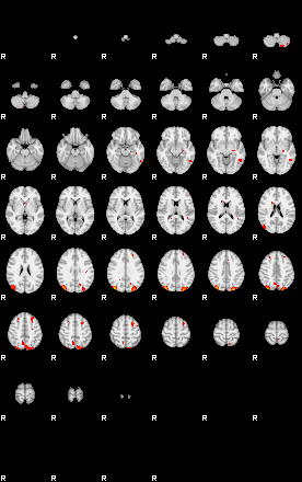 Patients 29060 2