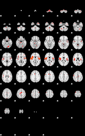 Patients 28920 176