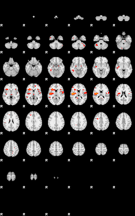 Patients 29069 193