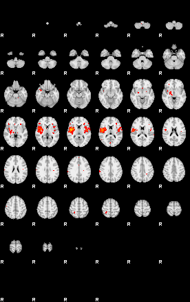 Patients 29107 160