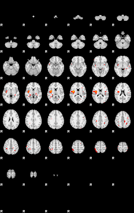 Patients 29156 169