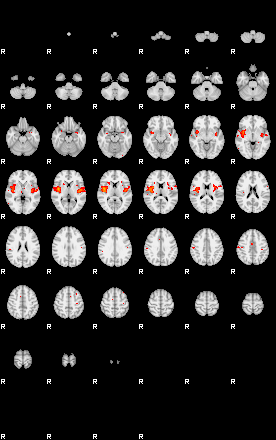 Patients 29220 172