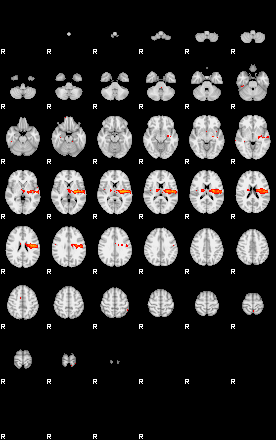 Patients 29514 75