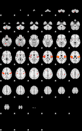 Patients 29666 194