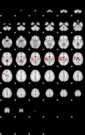 Patients 30017 158