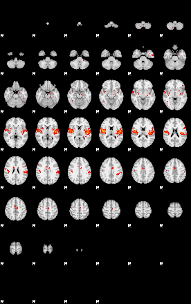 Patients 30017 91