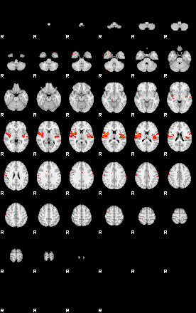 Patients 30179 170