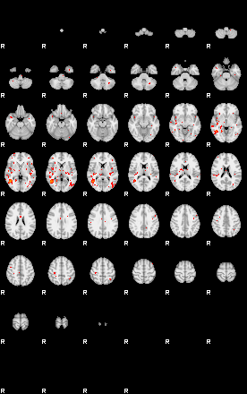 Patients 28920 151