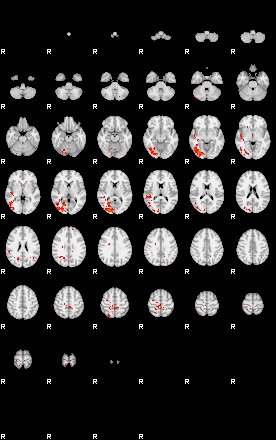 Patients 29010 184