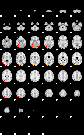 Patients 29167 122