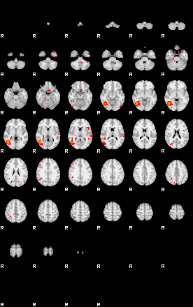 Patients 29179 113