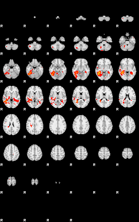 Patients 29180 139