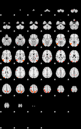 Patients 29205 125