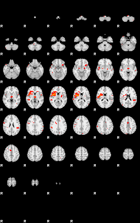 Patients 29100 161