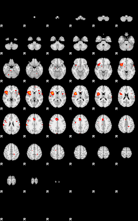 Patients 29166 171