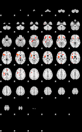 Patients 29410 173