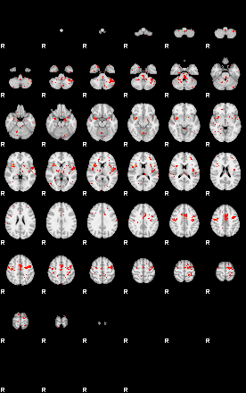 Patients 29595 90