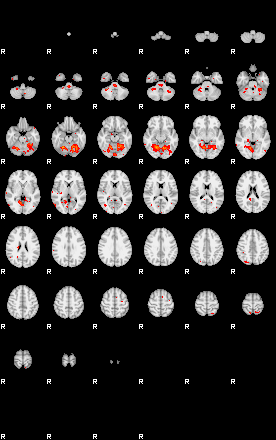 Patients 29180 98