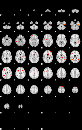 Patients 28718 29