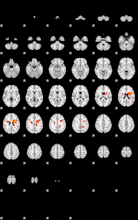 Patients 29009 24