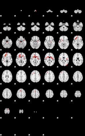 Patients 29039 135