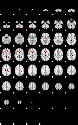 Patients 29177 30