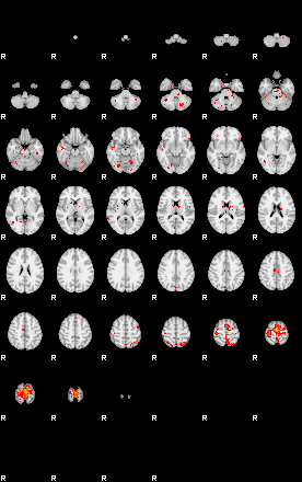 Patients 29015 112