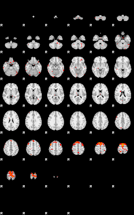 Patients 29028 191