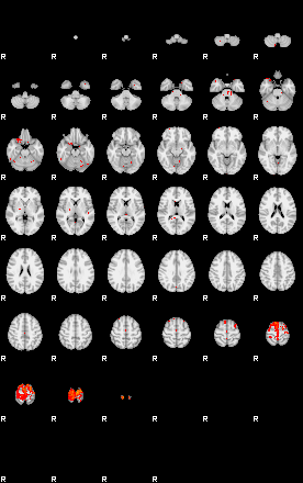 Patients 29029 124