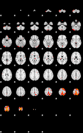 Patients 29057 192