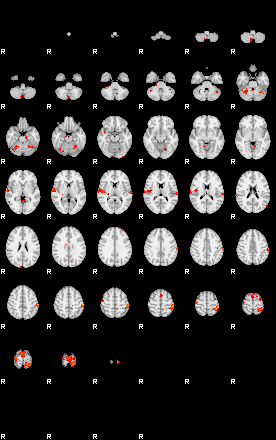 Patients 29103 57