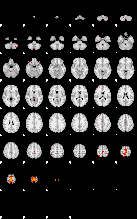 Patients 29113 179