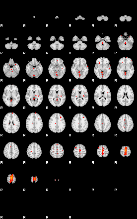 Patients 29170 118