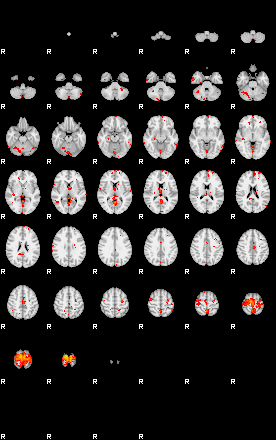 Patients 29181 115