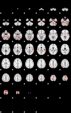 Patients 29185 21