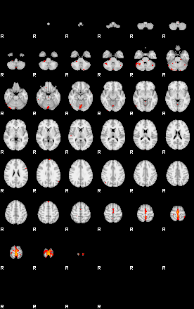 Patients 29223 200